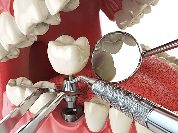 Best Emergency Treatment for Toothache in Hartwell, GA