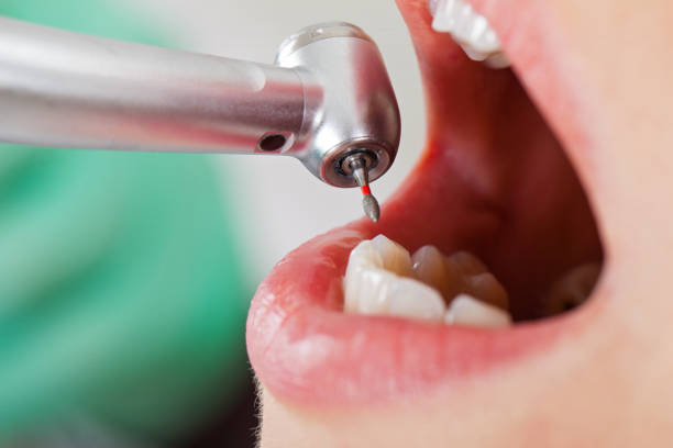 Best Pediatric Emergency Dentist in Hartwell, GA